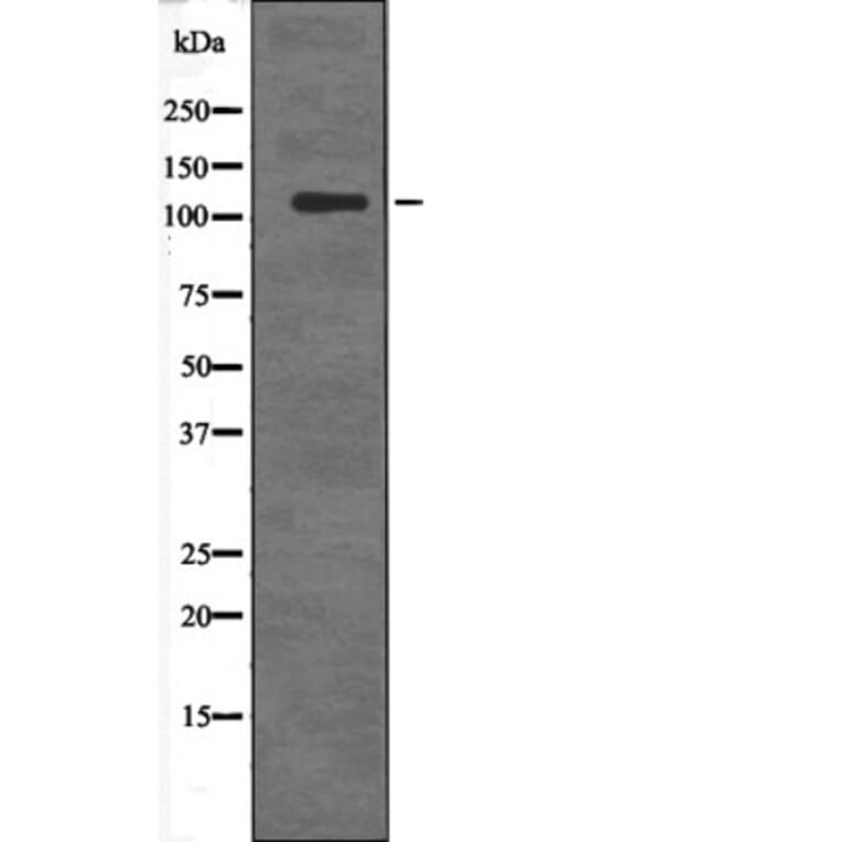 Western blot - DDEF2 (Phospho-Ser701) Antibody from Signalway Antibody (12678) - Antibodies.com