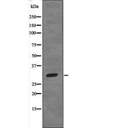 Western blot - HNRPA0 (Phospho-Ser84) Antibody from Signalway Antibody (12686) - Antibodies.com