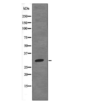 Western blot - HNRPA0 (Phospho-Ser84) Antibody from Signalway Antibody (12686) - Antibodies.com