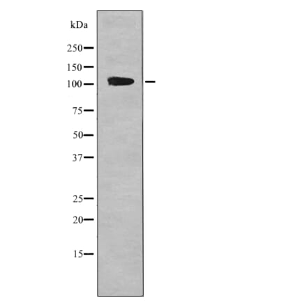 Western blot - EPHA1 (Phospho-Tyr599) Antibody from Signalway Antibody (12709) - Antibodies.com