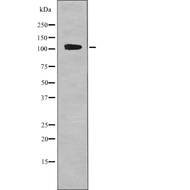 Western blot - EPHA1 (Phospho-Tyr599) Antibody from Signalway Antibody (12709) - Antibodies.com