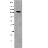 Western blot - EPHA1 (Phospho-Tyr781) Antibody from Signalway Antibody (12711) - Antibodies.com