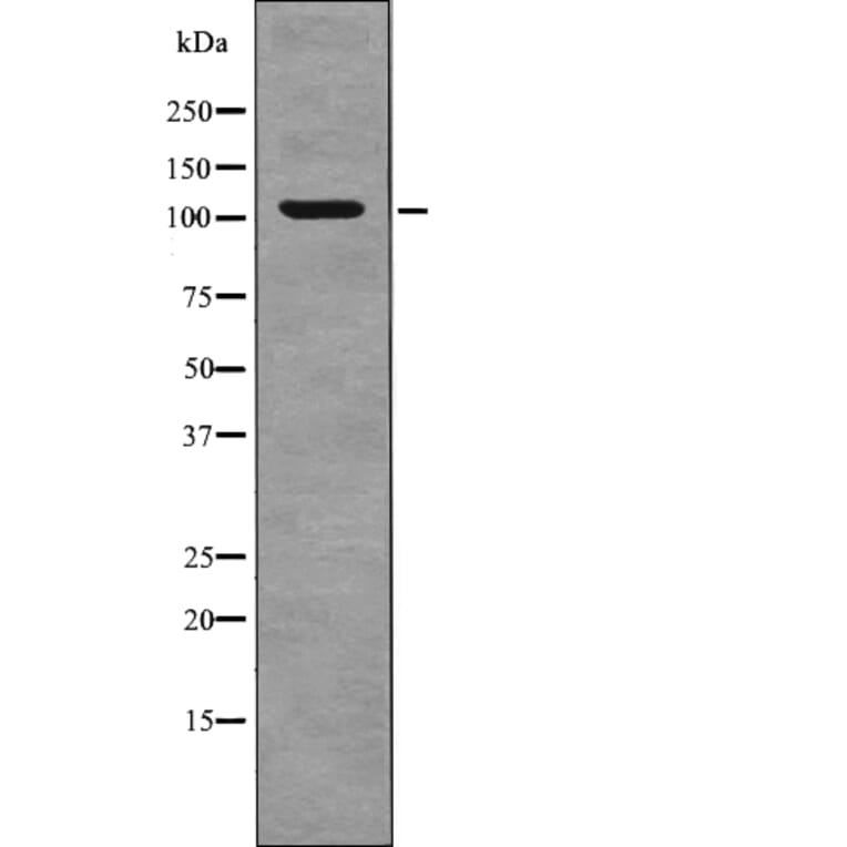 Western blot - EPHA2 (Phospho-Tyr930) Antibody from Signalway Antibody (12712) - Antibodies.com