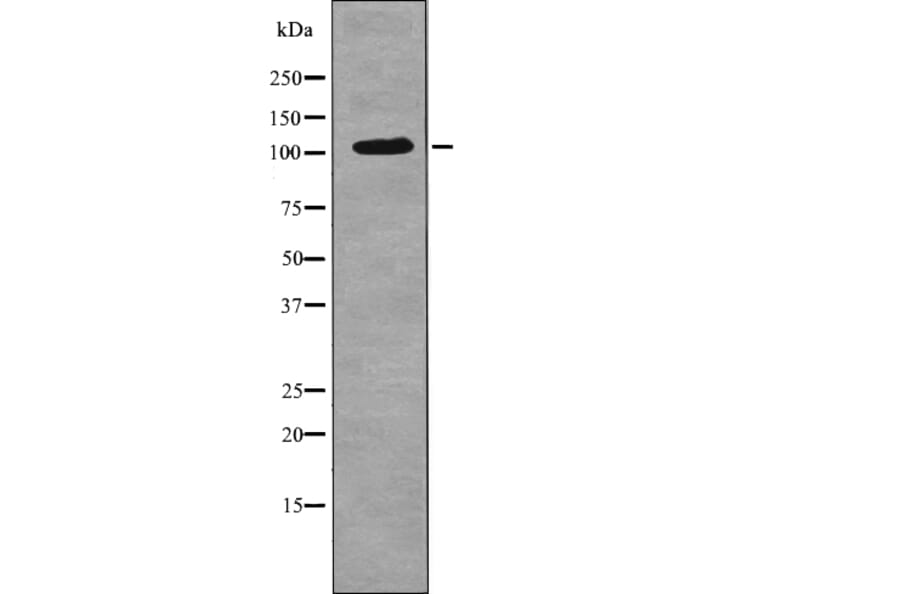 Western blot - EPHA3 (Phospho-Tyr602) Antibody from Signalway Antibody (12713) - Antibodies.com