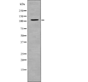 Western blot - EPHA5 (Phospho-Tyr650) Antibody from Signalway Antibody (12714) - Antibodies.com