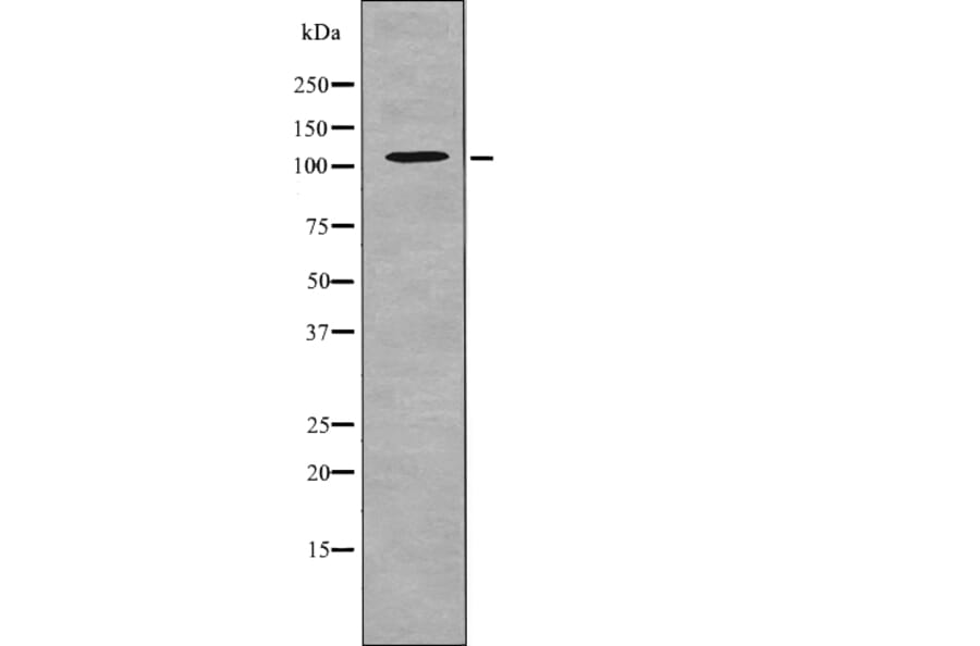 Western blot - EPHA5 (Phospho-Tyr650) Antibody from Signalway Antibody (12714) - Antibodies.com