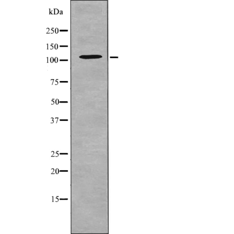 Western blot - EPHA5 (Phospho-Tyr650) Antibody from Signalway Antibody (12714) - Antibodies.com