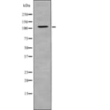 Western blot - EPHA5 (Phospho-Tyr650) Antibody from Signalway Antibody (12714) - Antibodies.com