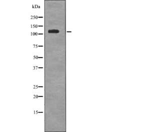 Western blot - EPHA6 (Phospho-Tyr977) Antibody from Signalway Antibody (12715) - Antibodies.com