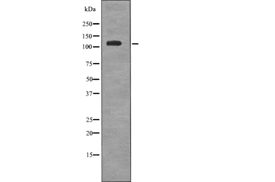 Western blot - EPHA6 (Phospho-Tyr977) Antibody from Signalway Antibody (12715) - Antibodies.com