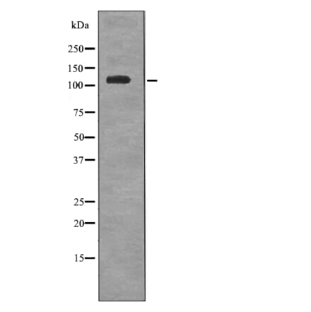 Western blot - EPHA6 (Phospho-Tyr977) Antibody from Signalway Antibody (12715) - Antibodies.com