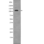 Western blot - EPHA6 (Phospho-Tyr977) Antibody from Signalway Antibody (12715) - Antibodies.com