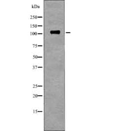 Western blot - EPHB1 (Phospho-Tyr928) Antibody from Signalway Antibody (12717) - Antibodies.com