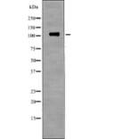 Western blot - EPHB1 (Phospho-Tyr928) Antibody from Signalway Antibody (12717) - Antibodies.com
