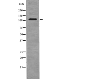 Western blot - EPHB3 (Phospho-Tyr608) Antibody from Signalway Antibody (12719) - Antibodies.com