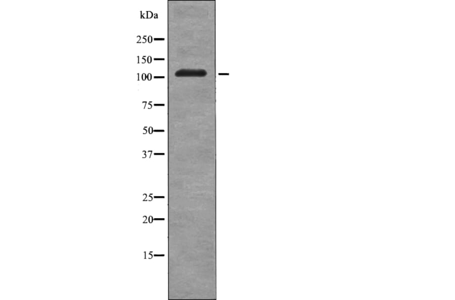 Western blot - EPHB3 (Phospho-Tyr608) Antibody from Signalway Antibody (12719) - Antibodies.com