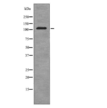 Western blot - EPHB3 (Phospho-Tyr608) Antibody from Signalway Antibody (12719) - Antibodies.com