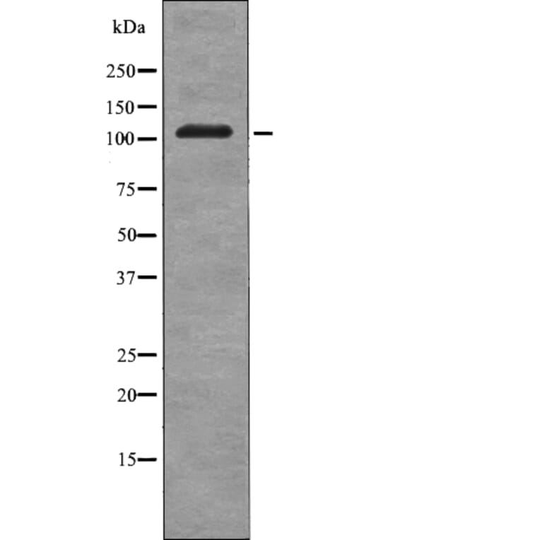 Western blot - EPHB3 (Phospho-Tyr608) Antibody from Signalway Antibody (12719) - Antibodies.com