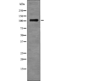 Western blot - EPHB4 (Phospho-Tyr987) Antibody from Signalway Antibody (12720) - Antibodies.com