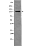 Western blot - EPHB4 (Phospho-Tyr987) Antibody from Signalway Antibody (12720) - Antibodies.com