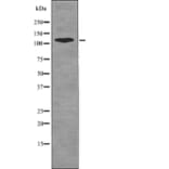Western blot - EPHB6 (Phospho-Tyr630) Antibody from Signalway Antibody (12721) - Antibodies.com