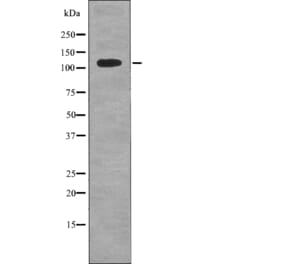 Western blot - EPHB6 (Phospho-Tyr636) Antibody from Signalway Antibody (12722) - Antibodies.com