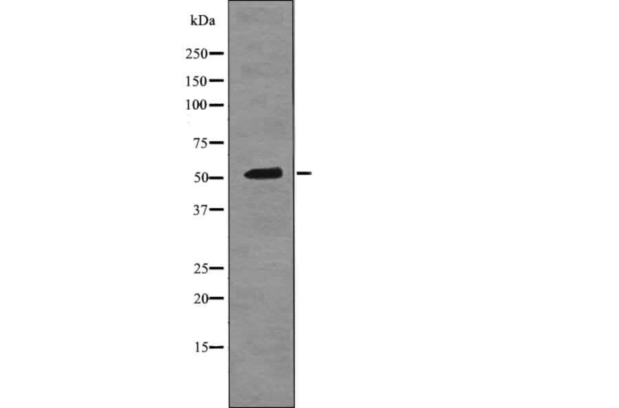 Western blot - Epo-R (Phospho-Tyr456) Antibody from Signalway Antibody (12723) - Antibodies.com