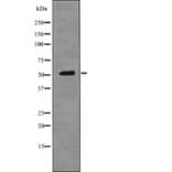 Western blot - Epo-R (Phospho-Tyr456) Antibody from Signalway Antibody (12723) - Antibodies.com