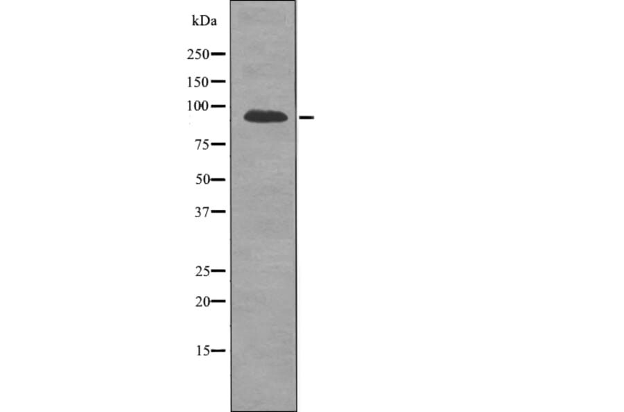 Western blot - FGFR2 (Phospho-Ser782) Antibody from Signalway Antibody (12724) - Antibodies.com