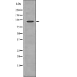 Western blot - FGFR3 (Phospho-Tyr577) Antibody from Signalway Antibody (12725) - Antibodies.com