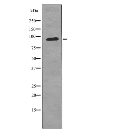 Western blot - FGFR3 (Phospho-Tyr724) Antibody from Signalway Antibody (12726) - Antibodies.com
