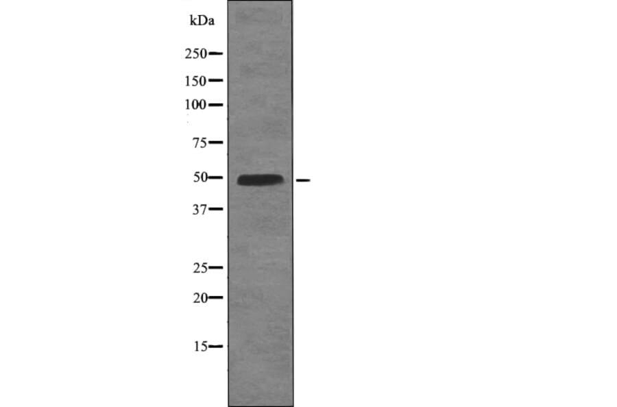 Western blot - BCL-3 (Phospho-Ser402) Antibody from Signalway Antibody (12746) - Antibodies.com