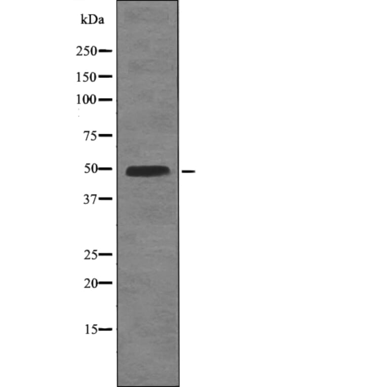 Western blot - BCL-3 (Phospho-Ser402) Antibody from Signalway Antibody (12746) - Antibodies.com