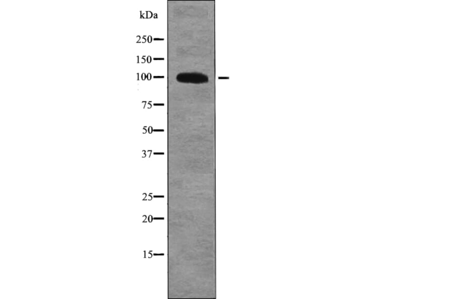 Western blot - GluR2 (Phospho-Tyr876) Antibody from Signalway Antibody (12758) - Antibodies.com