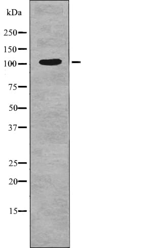 Western blot analysis INCENP (Phospho-Thr59) using heatshock treated HT29 whole cell lysates
