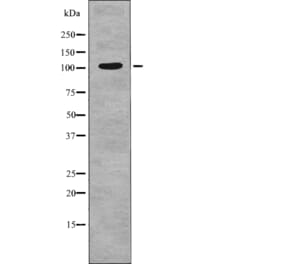 Western blot - INCENP (Phospho-Thr59) Antibody from Signalway Antibody (12762) - Antibodies.com
