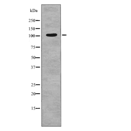 Western blot - INCENP (Phospho-Thr59) Antibody from Signalway Antibody (12762) - Antibodies.com