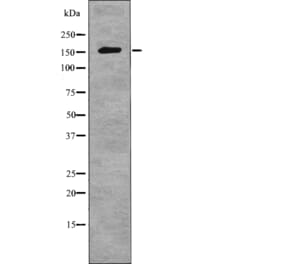 Western blot - NCoA3 (Phospho-Ser857) Antibody from Signalway Antibody (12765) - Antibodies.com