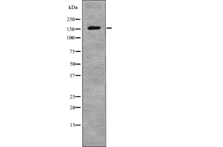 Western blot - NCoA3 (Phospho-Ser857) Antibody from Signalway Antibody (12765) - Antibodies.com