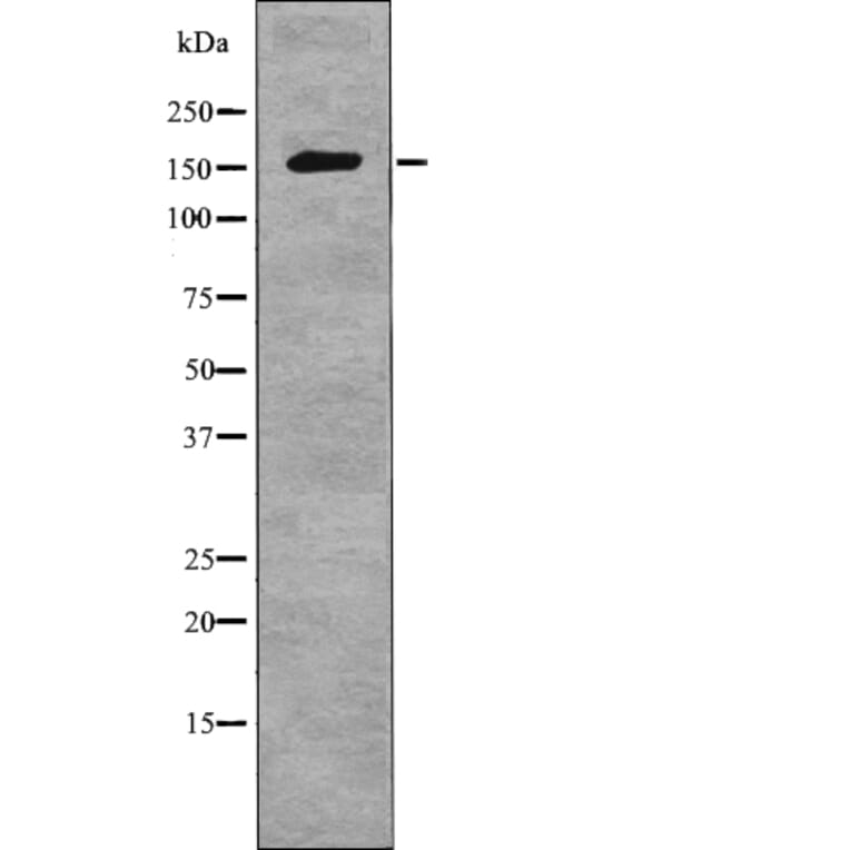 Western blot - NCoA3 (Phospho-Ser857) Antibody from Signalway Antibody (12765) - Antibodies.com