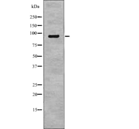 Western blot - NHE-3 (Phospho-Ser555) Antibody from Signalway Antibody (12768) - Antibodies.com