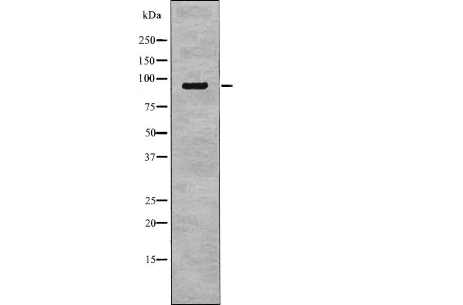 Western blot - NHE-3 (Phospho-Ser555) Antibody from Signalway Antibody (12768) - Antibodies.com