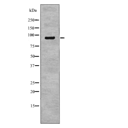 Western blot - NHE-3 (Phospho-Ser555) Antibody from Signalway Antibody (12768) - Antibodies.com