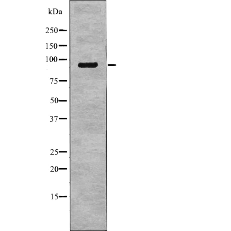 Western blot - NHE-3 (Phospho-Ser555) Antibody from Signalway Antibody (12768) - Antibodies.com