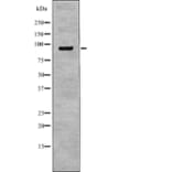 Western blot - NHE-3 (Phospho-Ser555) Antibody from Signalway Antibody (12768) - Antibodies.com