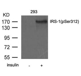 Western blot - IRS-1 (Phospho-Ser312) Antibody from Signalway Antibody (11143) - Antibodies.com