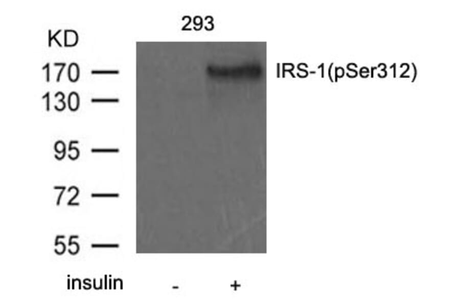 Western blot - IRS-1 (Phospho-Ser312) Antibody from Signalway Antibody (11143) - Antibodies.com