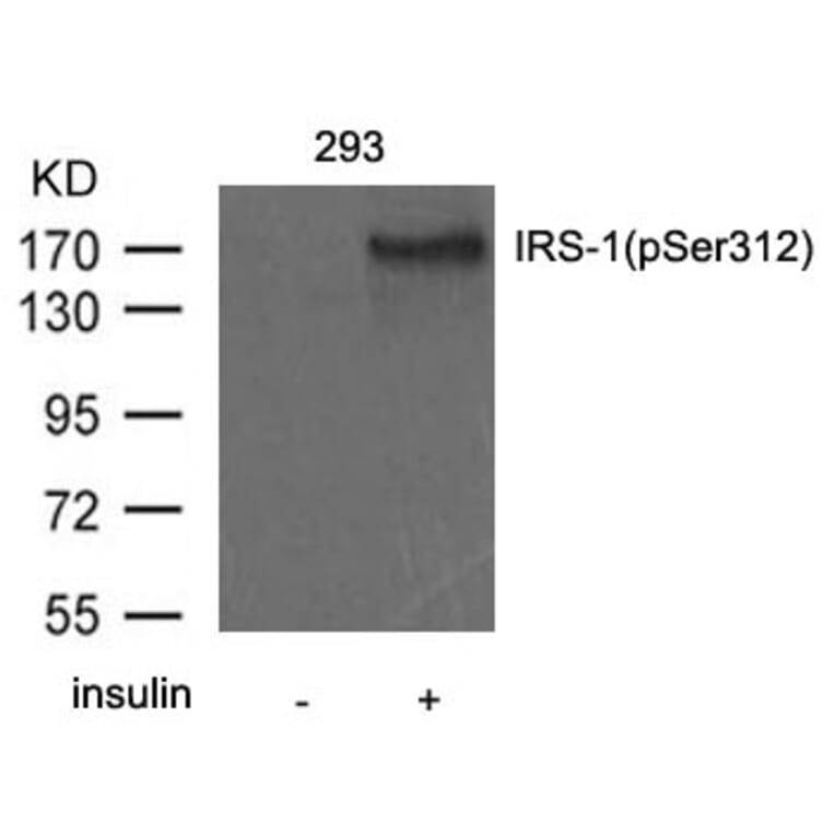 Western blot - IRS-1 (Phospho-Ser312) Antibody from Signalway Antibody (11143) - Antibodies.com