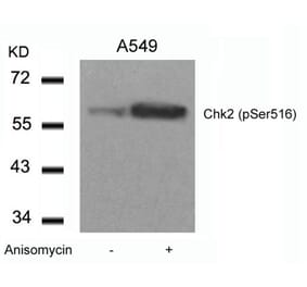 Western blot - Chk2 (Phospho-Ser516) Antibody from Signalway Antibody (11147) - Antibodies.com