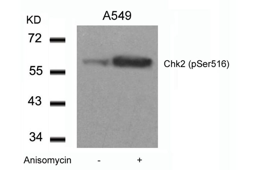 Western blot - Chk2 (Phospho-Ser516) Antibody from Signalway Antibody (11147) - Antibodies.com